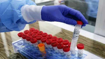 COVID-19: India Registers 30254 New Cases, 391 Deaths In Past 24 Hours