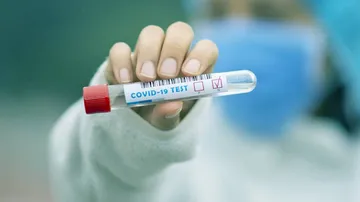 Health Department Should Get COVID19 Test Results First: Odisha To Private Hospitals