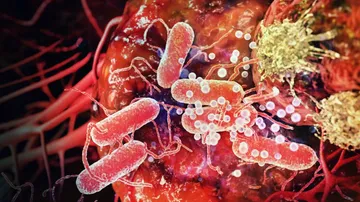 Researchers develop device to reduce chemotherapy's harmful side effects