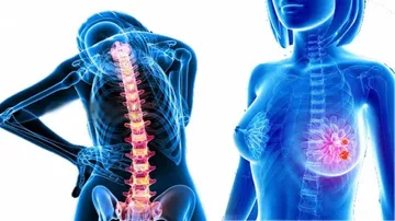 Dim light escalates breast cancer's spread to bones