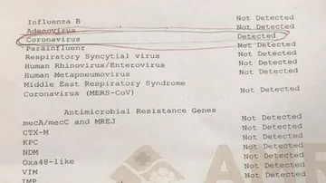 Microbiology Report Of Bhubaneswar AMRI Detecting Coronavirus In Elderly Patient Triggers Panic, Authorities Issue Clarification