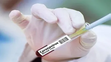 11,929 New Coronavirus Cases Reported In Last 24 hours In India
