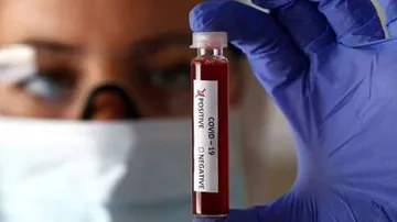 Global Covid-19 Caseload Tops 119.4 Million, Deaths Over 2.64 Million