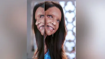 Deepika Padukone's acid attack survivor first look in Chhapaak out