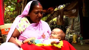 OTV Impact: Admin Extends Support to Infant With Hydrocephalus condition