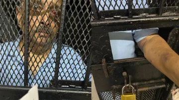 Fugitive Businessman Mehul Choksi's New Viral Pictures Show Injury Marks