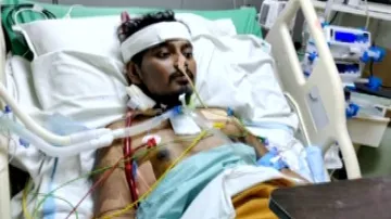 Covid-Hit Odisha Youth Amrit Breathes New Air, Undergoes Lung Transplant