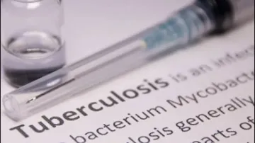 TB Curable If Right Drugs Taken For Right Duration: TB Institute Chief