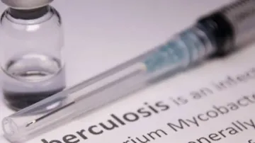 Body's response to different strains of TB could affect transmission