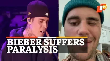 Justin Bieber, Ramsey Hunt Syndrome