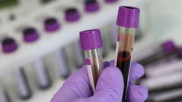 Hepatitis outbreak: WHO sounds alarm after reporting over 1000 cases