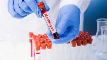 Suspected case of monkeypox in UP