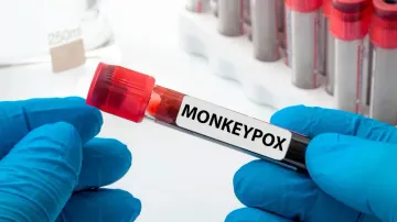 Peru faces 'community transmission' of monkeypox: Top health official