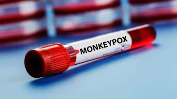 Delhi records second monkeypox case, nationwide tally reaches 6