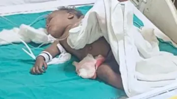 Toddler dies after being attacked by stray dogs in Noida