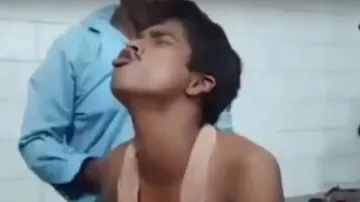 Man in Cuttack starts 'barking' after 6 months of dog bite