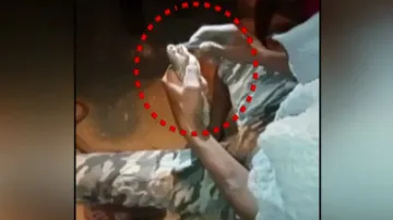 Man extracts cobra’s teeth 
