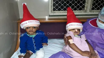 Separated conjoined twins Jaga & Kalia ring in Christmas with adorable Santa caps