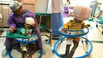 Separated conjoined twins: Jaga to get discharged soon, Kalia still recovering