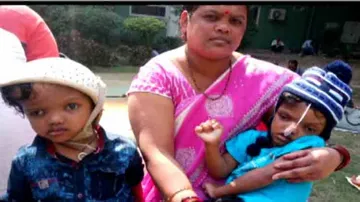 Odisha's Separated Craniopagus Twin Kalia No More