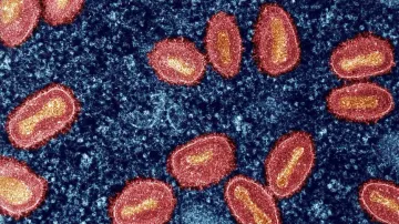MPox virus