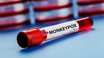Odisha issues 10-point precautionary measures to prevent monkeypox virus spread