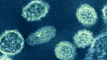 New Swine Flu Strain With Pandemic Potential Found In China