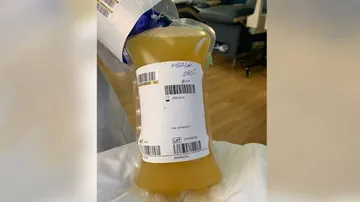 PGIMER's First Patient Treated With Plasma Therapy Recovers Fully