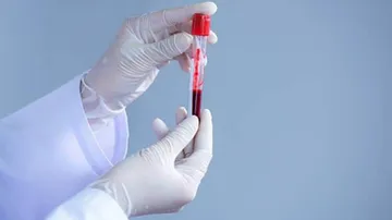 Plasma Therapy 101: Know In Details