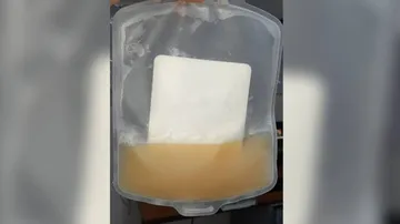 Plasma Therapy Boosts Survival In Covid Patients With Blood Cancers