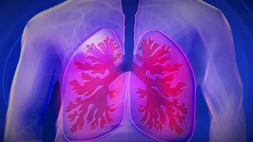 Respiratory Failure In Covid-19 Not Driven By Cytokine Storm, Reveals Study