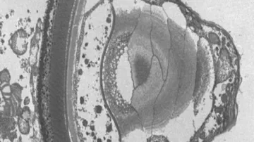 Single-celled predator evolves human-like 'eye'