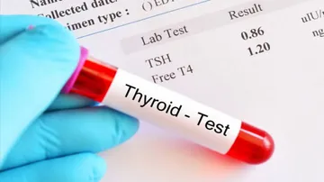 Patients With COVID-19 Infection May Develop Thyroid Disease