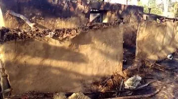Woman sustains critical burn injuries in fire mishap