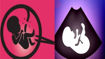 Female Foeticide Rampant in Odisha? Sex Ratio At Birth In 9 Districts Post Sharp Dip!