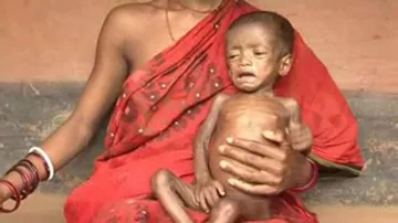 From 1990 - 2017, Malnutrition deaths still haunt Odisha!