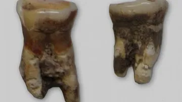 Ancient tooth reveals Mesolithic man ate fish, plants
