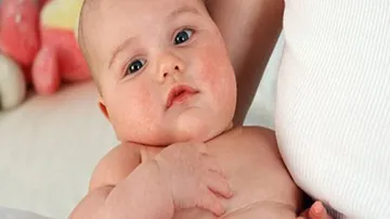 Breast milk may boost brain development of premature babies