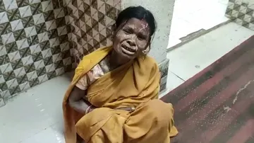 One-Year-Old Girl Dies After Falling In Bore Well Pit In Balasore
