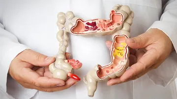 How gut bacteria, broccoli can help keep bowel cancer away