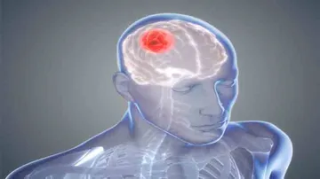 New drug shows promise in halting spread of brain cancer