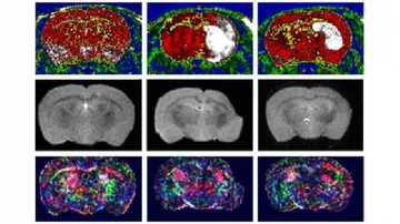 Novel stroke treatment repairs damaged brain tissue