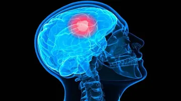 Bigger brains linked to higher cancer risk: Study