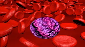 US researchers identify new way to slow down cancer development