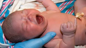 High insulin in newborns ups brain damage risk