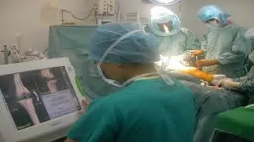 A bird's eye view of computer assisted surgery