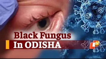 Black Fungus Found In #COVID19 Survivors In Odisha, Doctor Explains Ways To Prevent