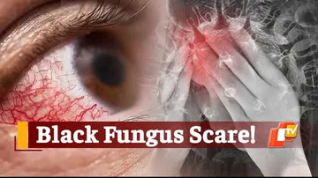 Odisha Declares 'Black Fungus' As Notifiable Disease Under Epidemic Act