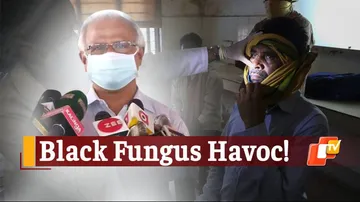 Black Fungus Has Claimed 18 Lives In Odisha, 129 Infections Detected So Far