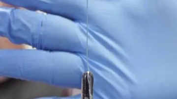 'Pill on a string' can detect cancer early: study